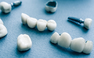 Porcelain crowns, a dental bridge, and an implant post on a blue surface